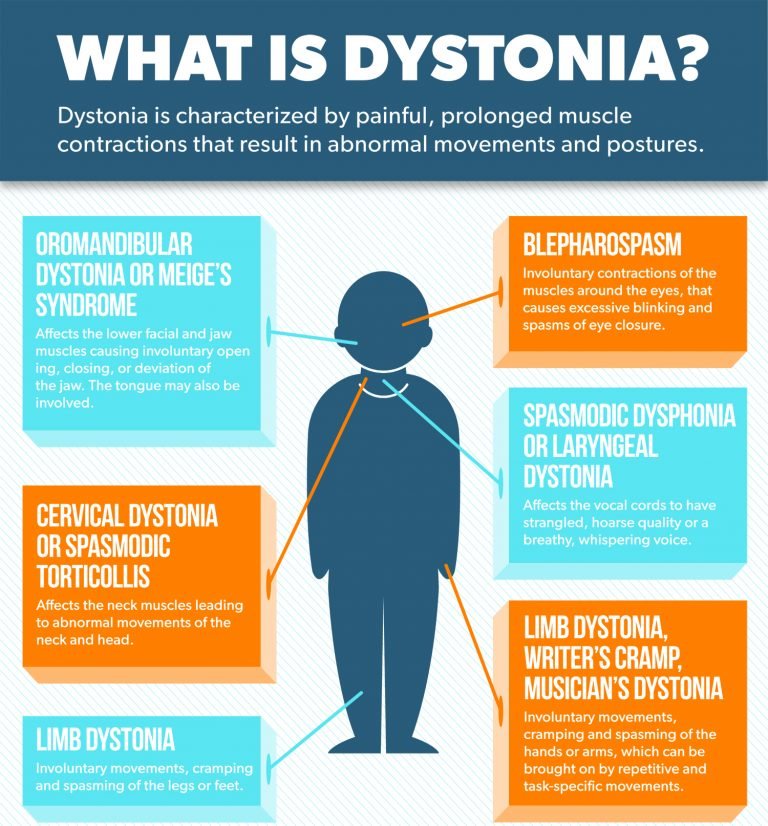 is dystonia serious