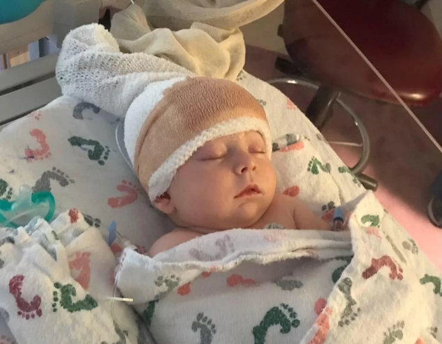 Baby Stopped Breathing After Hit by Softball - Few Weeks ...